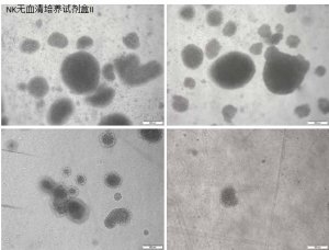 使用Corning? NK細胞無血清培養(yǎng)試劑盒II 高效地激活和擴增人類自然殺傷細胞 應(yīng)