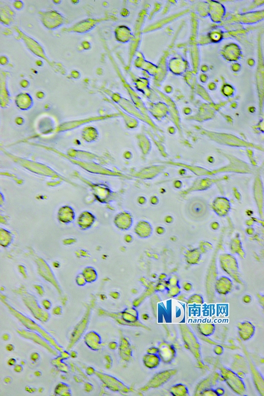 <p>    ↑目前臨床應(yīng)用最廣泛的細(xì)胞生物治療是C IK細(xì)胞治療，在顯微鏡下可清晰看到D C細(xì)胞(葉片形狀)和C IK細(xì)胞(圓點(diǎn)形狀)。</p>