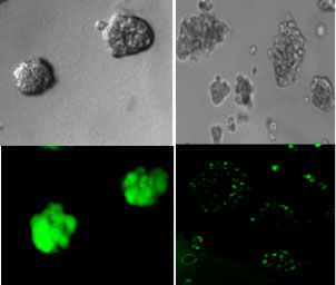 PLOS ONE:細菌的“通訊系統(tǒng)”可用于阻止或殺死癌細胞